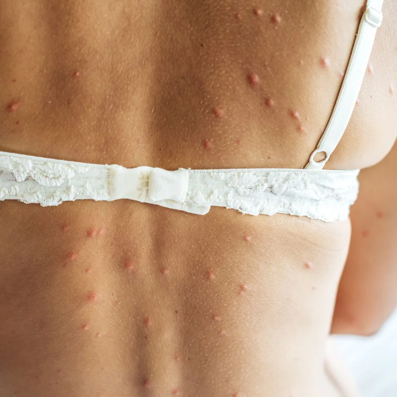 éradication de punaises de lit à Paris 13